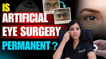 Is ARTIFICIAL EYE SURGERY permanent Explained by an eye plastic surgeon | Eye | Dr Anamika Joshi