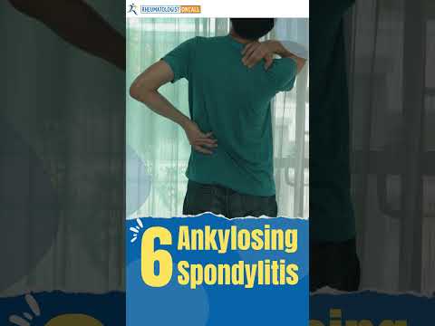 Video: Sklerodermie: simptome, behandeling en prognose