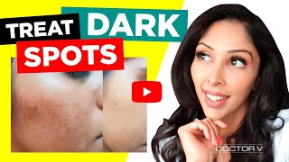 Doctor V - How To Treat Dark Marks For Skin Of Colour | Brown Or Black Skin