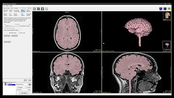 Analyze 15.0 - Segment: Morph Objects
