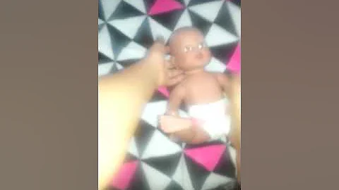 Alive baby not pieing