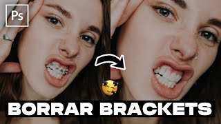 Como quitar brackets en Photoshop | Tutorial Photoshop | Sinergia screenshot 5