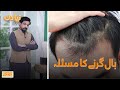 Season Hair Fall Problem | Naya Din | SAMAA TV