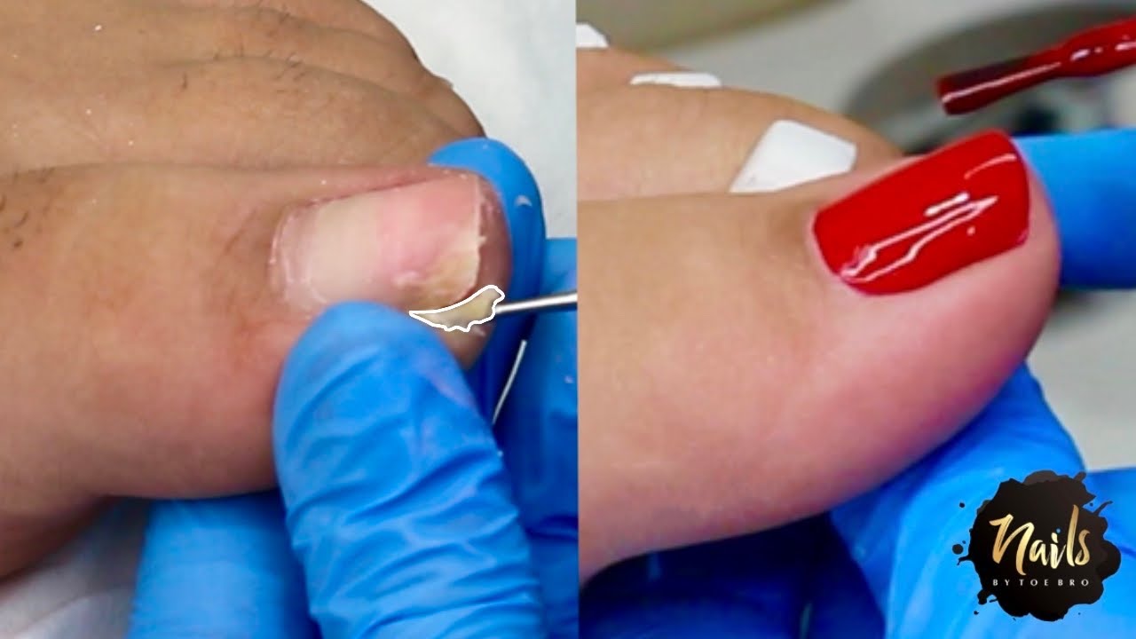 PREGNANT WOMAN TREATS HERSELF TO PEDICURE PARADISE 🤰🏝 ♥️