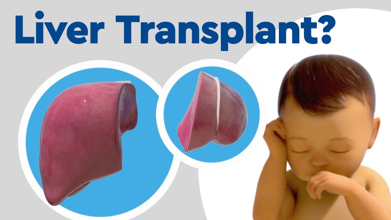 Pediatric Liver Transplant Options Youtube