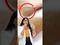 Crack Heel| Cracked Heel| Cracked heels Cream| Crack heel Cream| A Dermatologist's Guide|