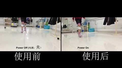 Functional Electrical Stimulation (FES) Foot Drop Treatment Brain Neurological Rehabilitation