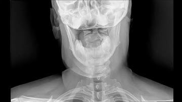Dynamic Digital Radiography   DDR Imaging