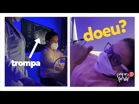 Vídeo: Ultra-som Para Patência Das Trompas De Falópio - Por Que E Como é Realizado?