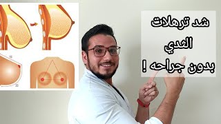 شد ترهلات الثدي بالخيوط بدون جراحه screenshot 1