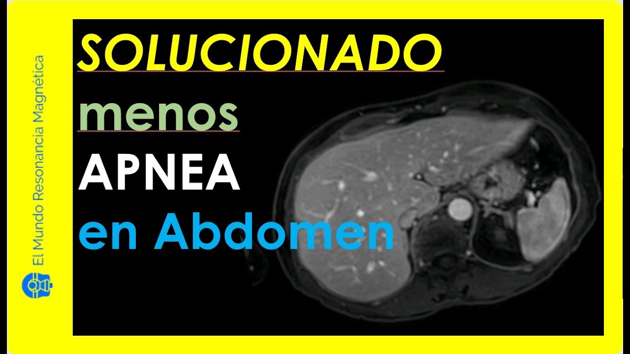 🚀 Paso a paso para BAJAR TIEMPO de APNEA en secuencia Dinámica de Resonancia Magnética Abdominal.