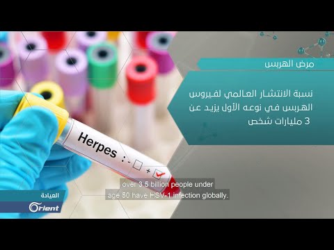 فيديو: كيف تبدو عيون الآخرين (بالصور)