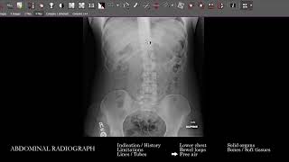 [XR] Abdominal Radiograph | Search Pattern