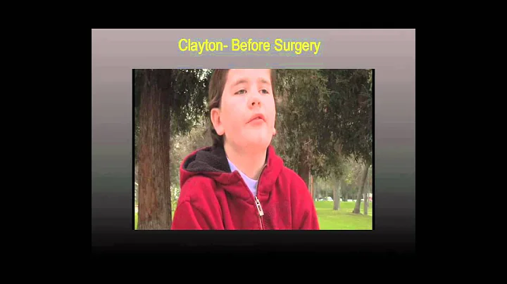 What can you do with half a brain? Dr. Gary Mathern at TEDxConejo