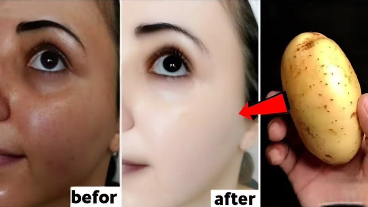 Japanese Secret To Whitening 10 Shades That Removes Wrinkles And Pigmentation For Snow White Skin