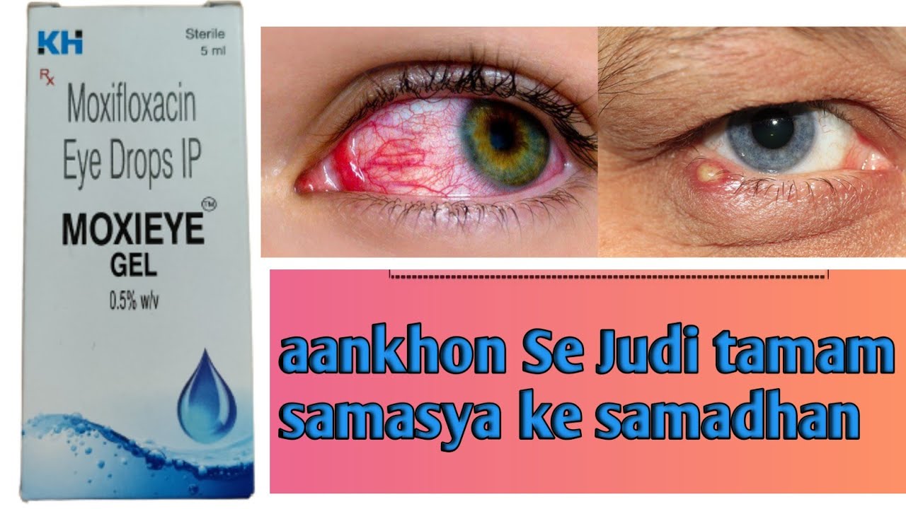 Moxifloxacin Eye Drops! Uses! Side Effects! Benefits moxifloxacin 