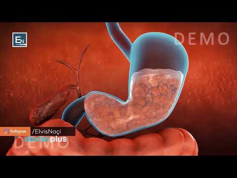 Video: Cili është roli i profageve në patogjenitetin bakterial?