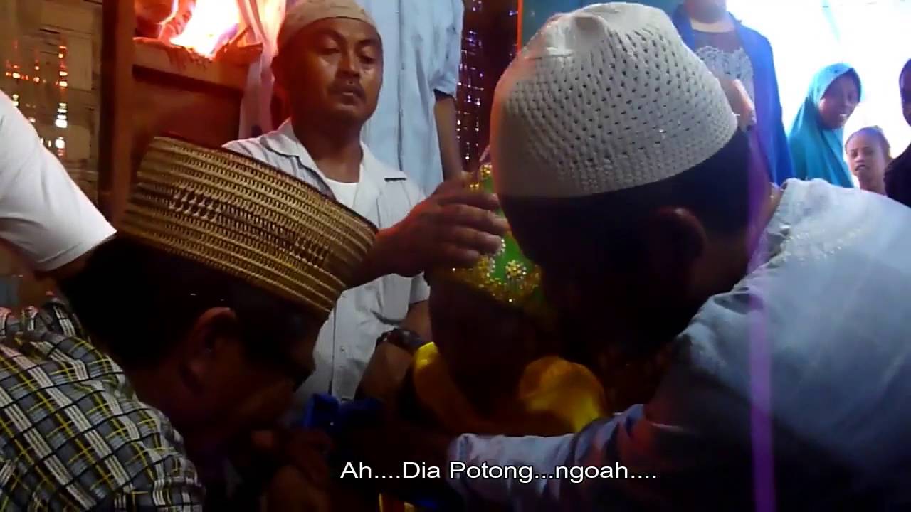 Lucunya .... Histeris Ketika Di Khitan