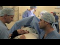 Spinal Anaesthetia for Caesarean Section