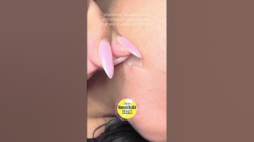 Best Pimple Patches 🏆