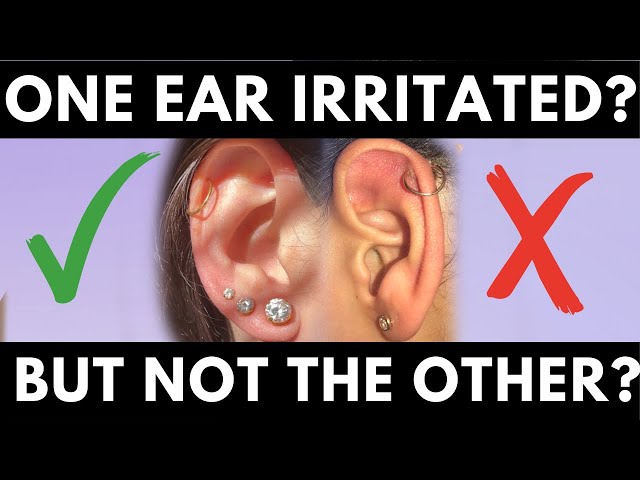 If I take out an infected ear piercing, is it true that the infection will  get trapped inside when the hole closed? - Quora