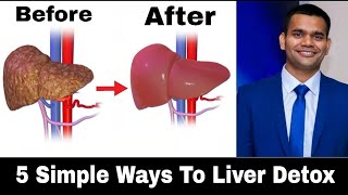 Liver Detox - 5 Simple Ways to Liver Detox