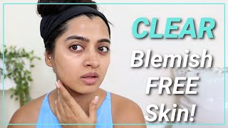 Skin Care Routine: How I got Rid of my Summer  Acne & Acne Spots!