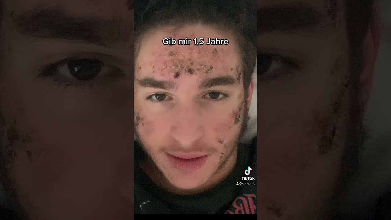 Gib mir 1,5 Jahre Glow up… Insta: chris.mrb folgt gerne #glowup