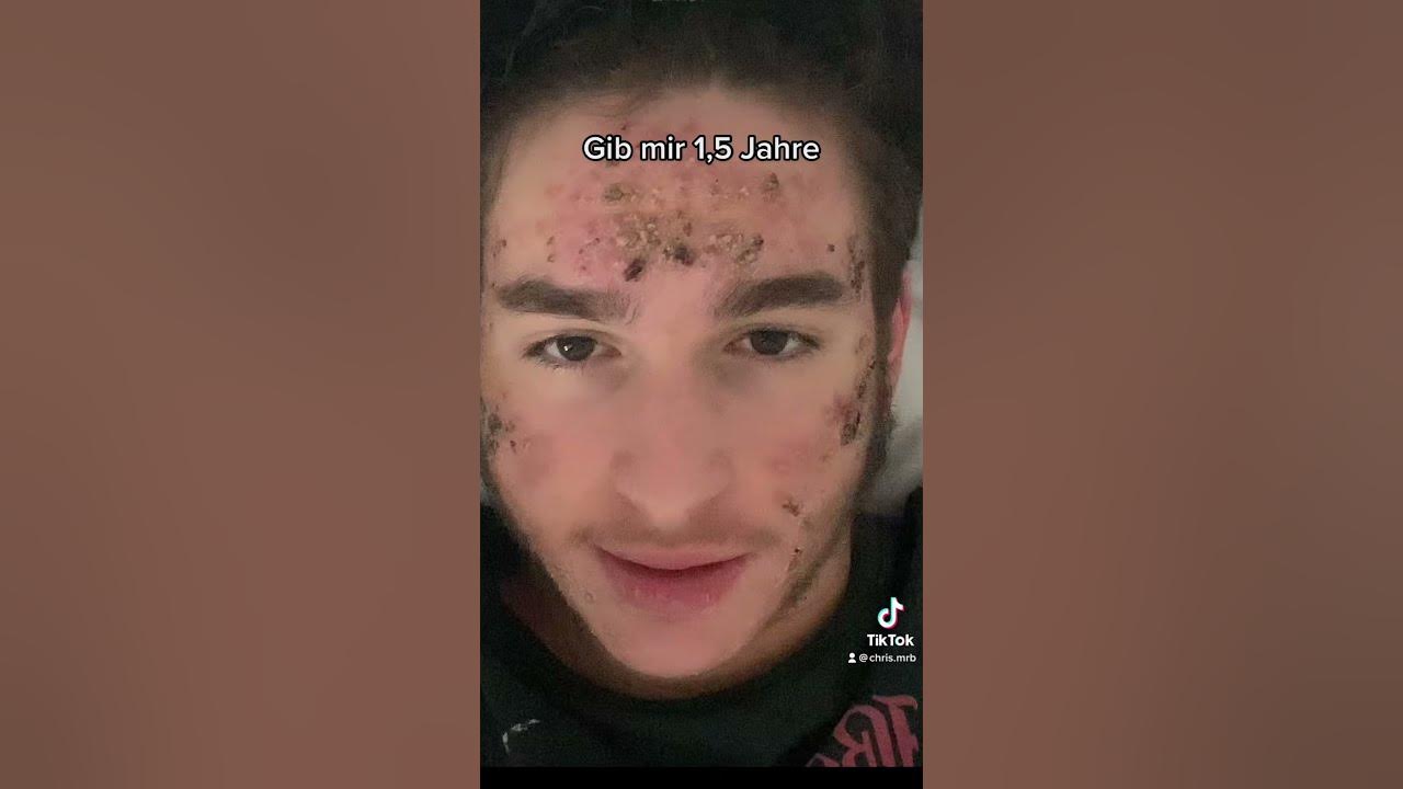 Gib mir 1,5 Jahre Glow up… Insta: chris.mrb folgt gerne #glowup