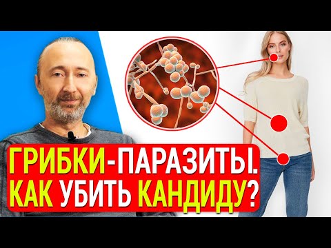 Как избавиться от Кандиды? Ошибки в лечении кандидоза! Молочницу и грибок ног надо лечить вот как!