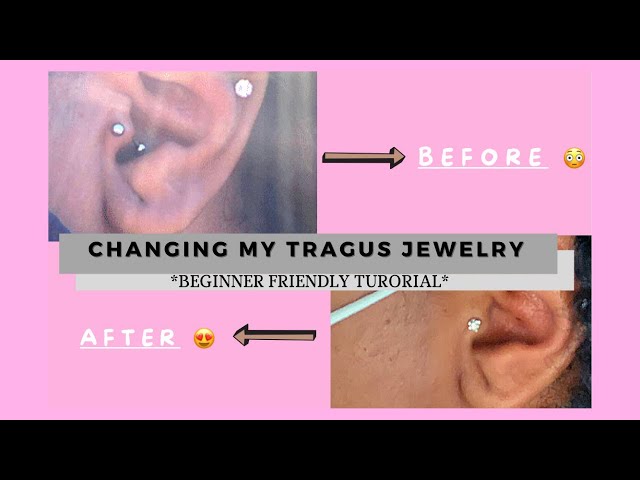 Tragus is so angry! I got the jewelry changed, had the piercer put the no  pull disc on and continuing with saline spray….but the bump is getting  worse. What am I doing