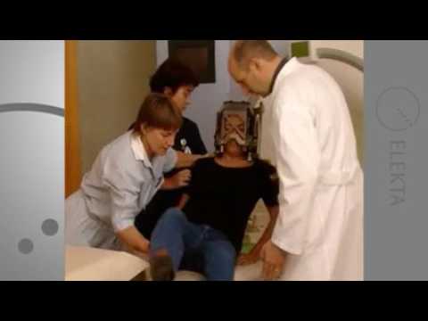 Photo Gamma Knife Treatment