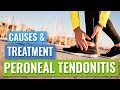 Peroneal Tendinopathy or Tendonitis Causes & Treatment