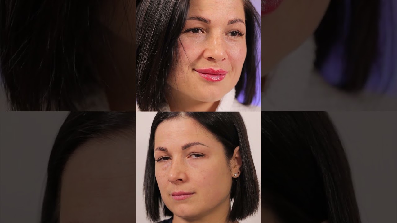 Контурная пластика губ