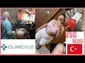 MY GASTRIC SLEEVE SURGERY IN TURKEY VLOG | CLINIC HUB | COMPLICATIONS?| DR TUNA BILECIK | 23-10-2020