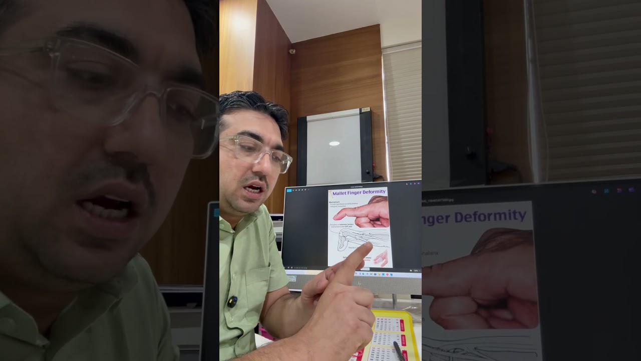 Best orthopedic knee replacement doctor Ahmedabad Dr Kalpesh Mehta Asian orthopedic 9879517351