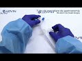 Tubo de reemplazo de gastrostomía | Reemplazo del tubo PEG | Sonda de gastrostomía