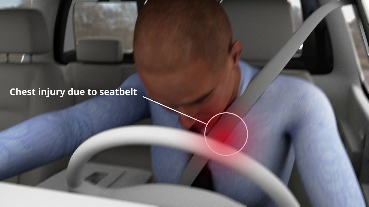 Seat Belt Injuries Due to Car Crash Accident Reconstruction Experts