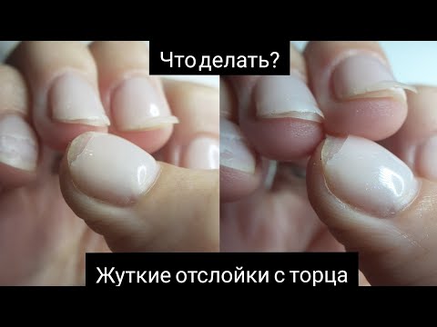 НОГТЕЙ ХВАТИЛО НА 3 ДНЯ|ЖУТКИЕ ОТСЛОЙКИ|КАК УКРЕПЛЯТЬ ОЧЕНЬ ТОНКИЕ НОГТИ