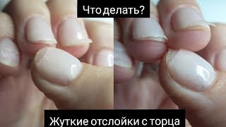 НОГТЕЙ ХВАТИЛО НА 3 ДНЯ|ЖУТКИЕ ОТСЛОЙКИ|КАК УКРЕПЛЯТЬ ОЧЕНЬ ТОНКИЕ НОГТИ