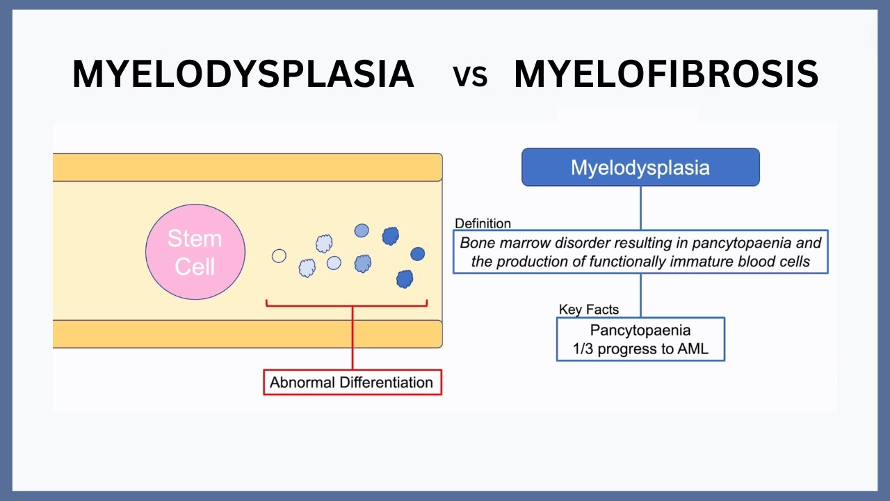 Is Primary Myelofibrosis Hereditary