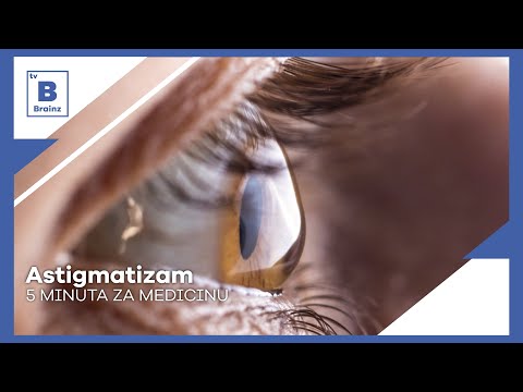 5 minuta za medicinu - Astigmatizam