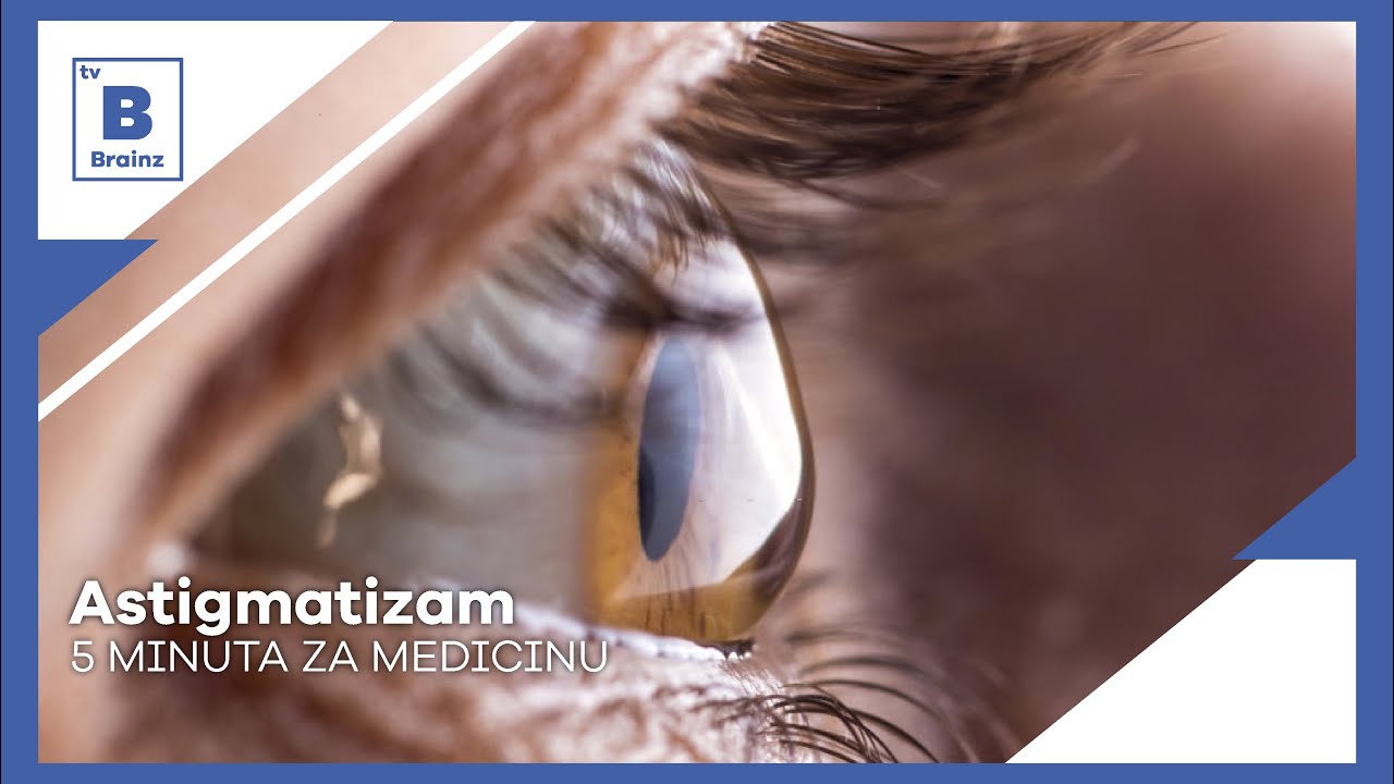 5 minuta za medicinu - Astigmatizam