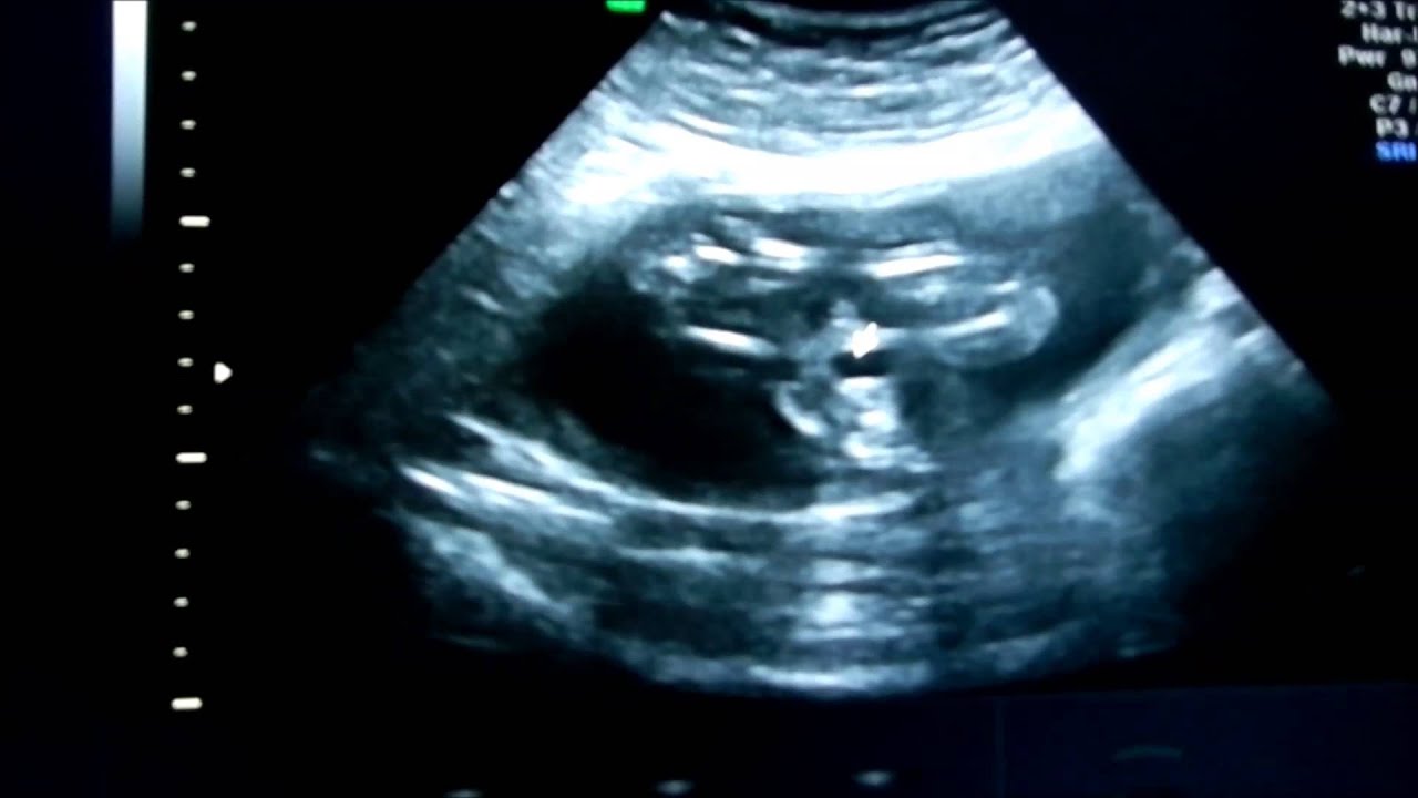 Baby Boy Scan YouTube