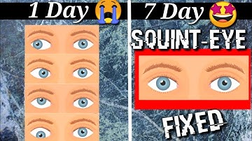 Fix Squint eye with EXERCISE at Home