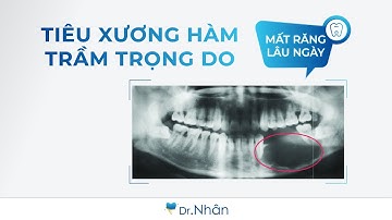 TIÊU XƯƠNG HÀM TRẦM TRỌNG DO MẤT RĂNG LÂU NGÀY | NHA KHOA NHÂN TÂM