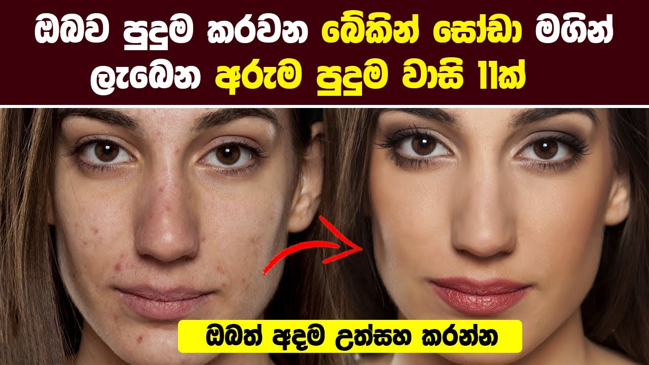 බේකින් සෝඩා මගින් ලැබෙන අරුම පුදුම වාසි 11ක් - කාන්තාවන්ට විශේෂයි | Super Benefits Of Baking Soda