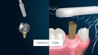 MIS CONNECT - Versatile One Time Solution
