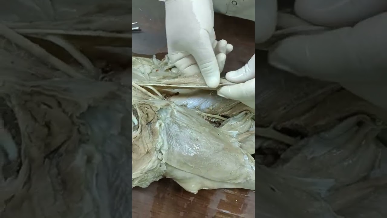 Nerve supply of hind limb - دكتور رمضان ساري