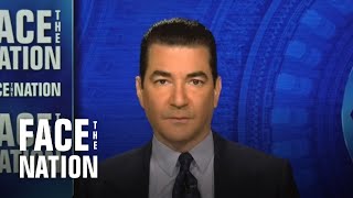 Gottlieb says side of the ledger suggesting COVID-19 was result of lab leak has expanded